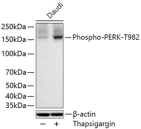 Phospho-PERK-T982 Polyclonal Antibody