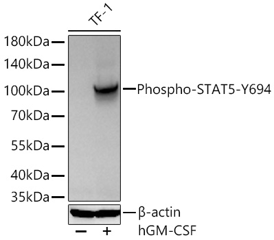Phospho-STAT5-Y694 Polyclonal Antibody