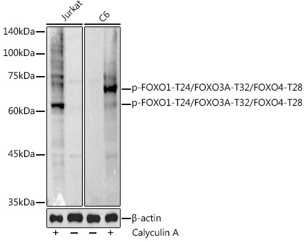 Phospho-FOXO1-T24/FOXO3A-T32/FOXO4-T28 Polyclonal Antibody