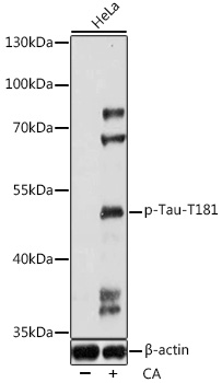 Phospho-Tau-T181 Polyclonal Antibody