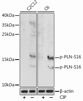 Phospho-PLN-S16 Polyclonal Antibody