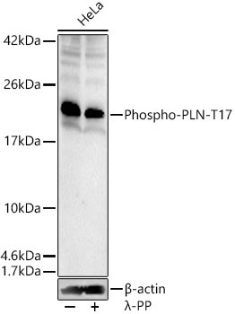 Phospho-PLN-T17 Polyclonal Antibody