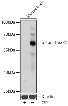 Phospho-Tau-T231 Polyclonal Antibody