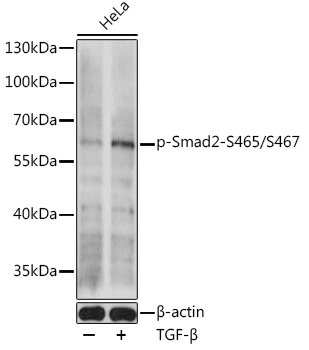 Phospho-Smad2-S465/S467 Polyclonal Antibody