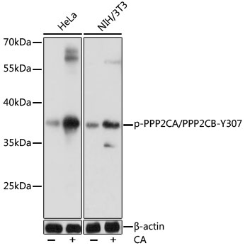 Phospho-PPP2CA/PPP2CB-Y307 Polyclonal Antibody