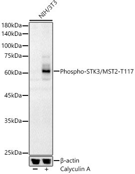 Phospho-STK3/MST2-T117 Polyclonal Antibody