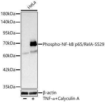 Phospho-NF-kB p65/RelA-S529 Polyclonal Antibody