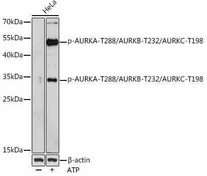 Phospho-AURKA-T288/AURKB-T232/AURKC-T198 Polyclonal Antibody