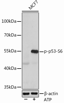 Phospho-p53-S6 Polyclonal Antibody