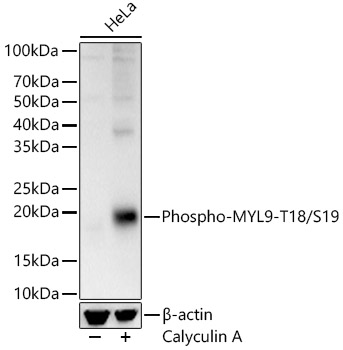 Phospho-MYL9-T18/S19 Polyclonal Antibody