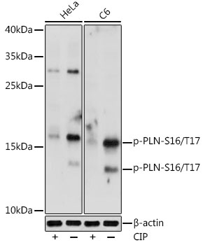Phospho-PLN-S16/T17 Polyclonal Antibody