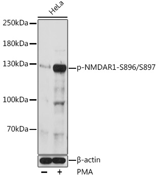 Phospho-NMDAR1-S896/S897 Polyclonal Antibody