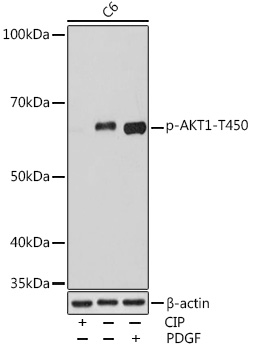 Phospho-AKT1-T450 Monoclonal Antibody [10M6Q2]