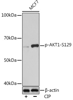 Phospho-AKT1-S129 Monoclonal Antibody [7M4I8]