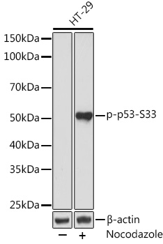 Phospho-p53-S33 Monoclonal Antibody [2Y4T8]