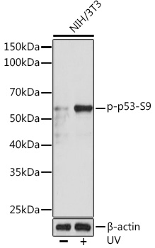 Phospho-p53-S9 Monoclonal Antibody [10U5R6]