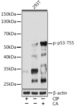 Phospho-p53-T55 Monoclonal Antibody [7I0A7]