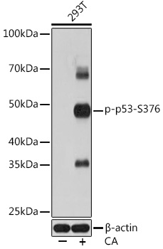 Phospho-p53-S376 Monoclonal Antibody [2S2L0]