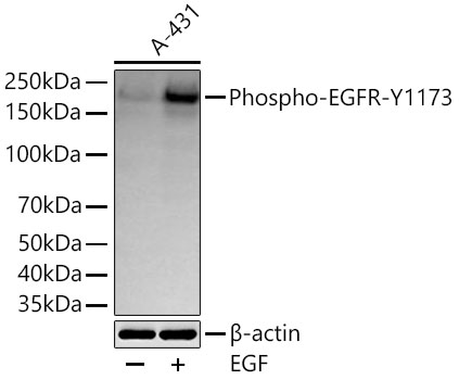 Phospho-EGFR-Y1173 Monoclonal Antibody [4H3F8]