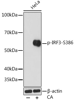 Phospho-IRF3-S386 Monoclonal Antibody [6D3D1]