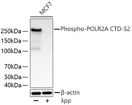 Phospho-POLR2A CTD-S2 Monoclonal Antibody [10H5J8]