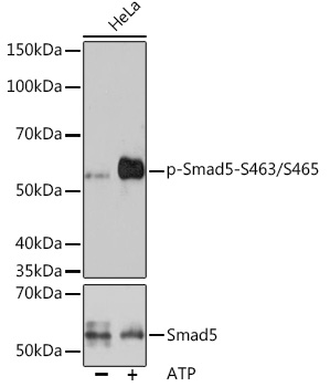 Phospho-Smad5-S463/S465 Monoclonal Antibody [8F4B10]