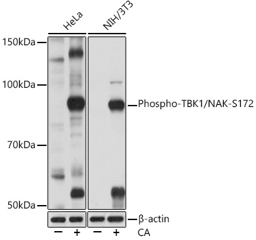 Phospho-TBK1/NAK-S172 Monoclonal Antibody [5B8P1]