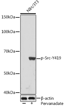 Phospho-Src-Y419 Monoclonal Antibody [8G4P4]