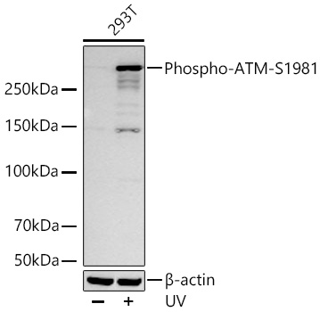 Phospho-ATM-S1981 Monoclonal Antibody [8V0Z2]