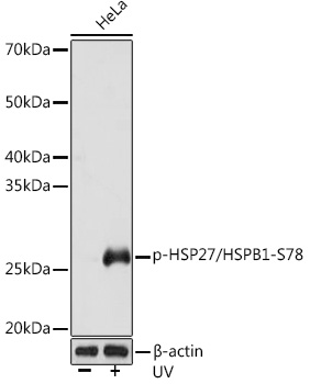 Phospho-HSP27/HSPB1-S78 Monoclonal Antibody [4R7E5]