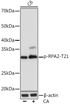 Phospho-RPA2-T21 Monoclonal Antibody [4I3A0]
