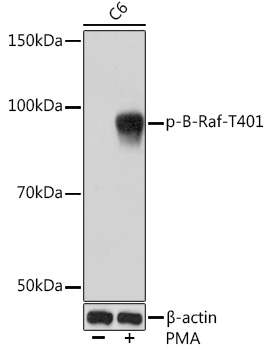 Phospho-B-Raf-T401 Monoclonal Antibody [5G6Q5]
