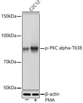 Phospho-PKC alpha-T638 Monoclonal Antibody [5J2R8]