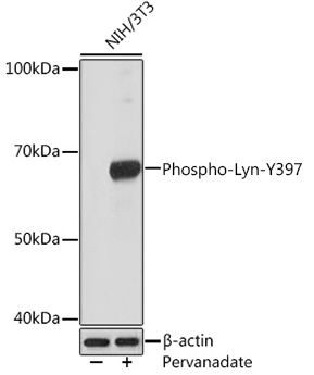 Phospho-Lyn-Y397 Monoclonal Antibody [5I5G8]