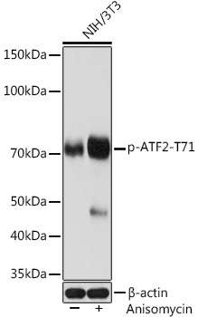 Phospho-ATF2-T71 Monoclonal Antibody [10L9M2]