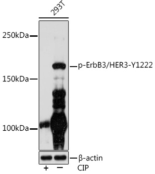 Phospho-ErbB3/HER3-Y1222 Monoclonal Antibody [5Z1F0]
