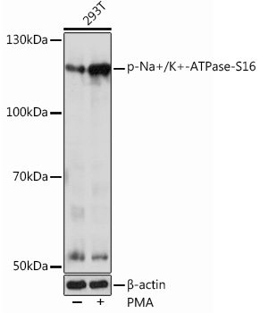Phospho-Na+/K+-ATPase-S16 Polyclonal Antibody