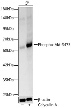 Phospho-Akt-S473 Polyclonal Antibody