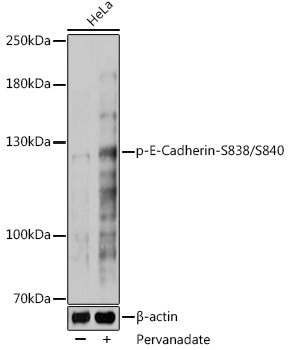 Phospho-E-Cadherin-S838/S840 Polyclonal Antibody