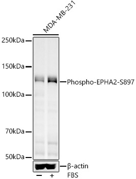 Phospho-EPHA2-S897 Polyclonal Antibody