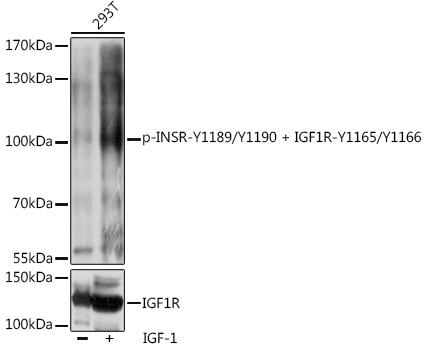 Phospho-INSR-Y1189/Y1190 + IGF1R-Y1165/Y1166 Polyclonal Antibody