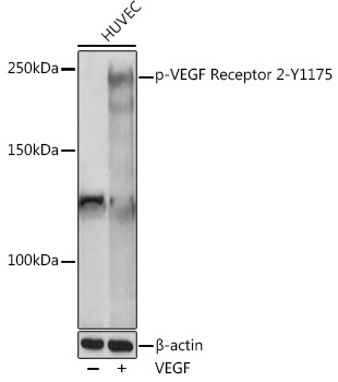 Phospho-VEGF Receptor 2-Y1175 Polyclonal Antibody
