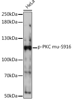 Phospho-PKC mu-S916 Polyclonal Antibody