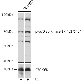 Phospho-p70 S6 Kinase 1-T421/S424 Polyclonal Antibody