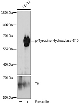 Phospho-Tyrosine Hydroxylase-S40 Polyclonal Antibody
