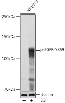 Phospho-EGFR-Y869 Polyclonal Antibody