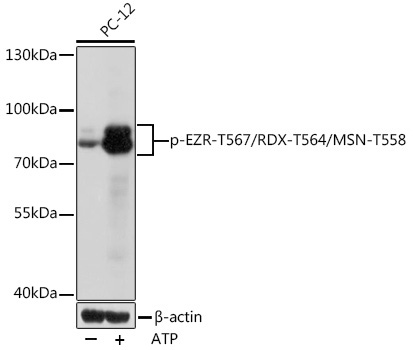 Phospho-EZR-T567/RDX-T564/MSN-T558 Polyclonal Antibody