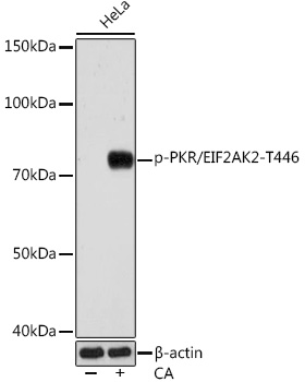 Phospho-PKR/EIF2AK2-T446 Monoclonal Antibody [5S9X7]
