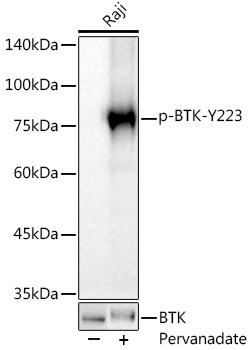 Phospho-BTK-Y223 Monoclonal Antibody [10F4W10]