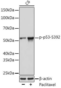 Phospho-p53-S392 Monoclonal Antibody [5S9P3]